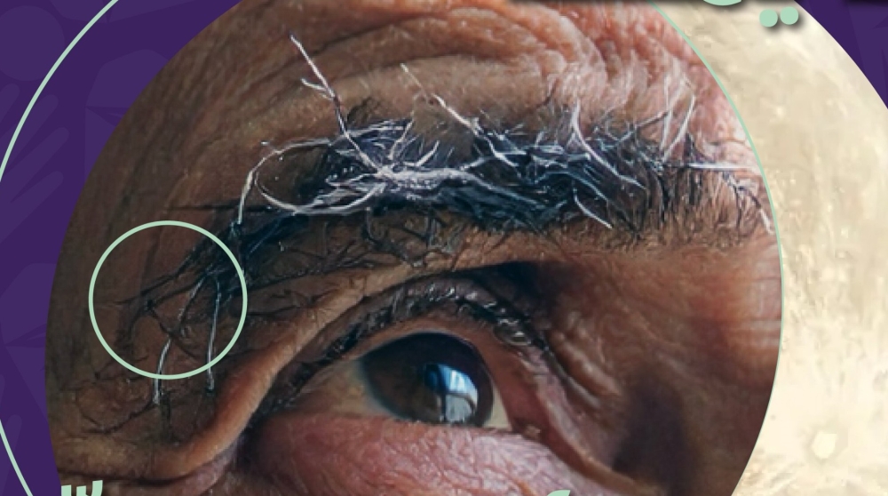 قافلة-طبية-وغذائية-لدعم-1820-أسرة-لمرضى-ألزهايمر-بالمملكة