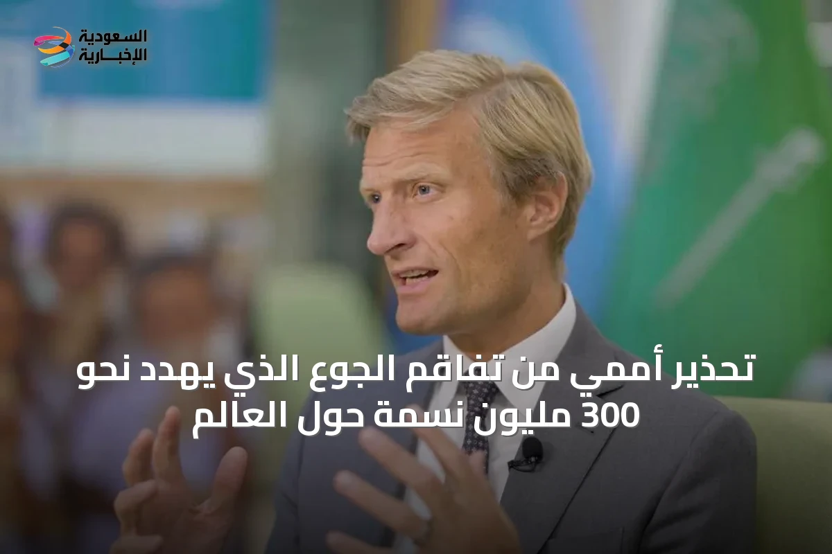 تحذير أممي من تفاقم الجوع الذي يهدد نحو 300 مليون نسمة حول العالم