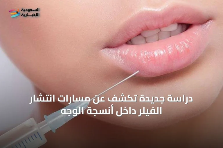 دراسة جديدة تكشف عن مسارات انتشار الفيلر داخل أنسجة الوجه