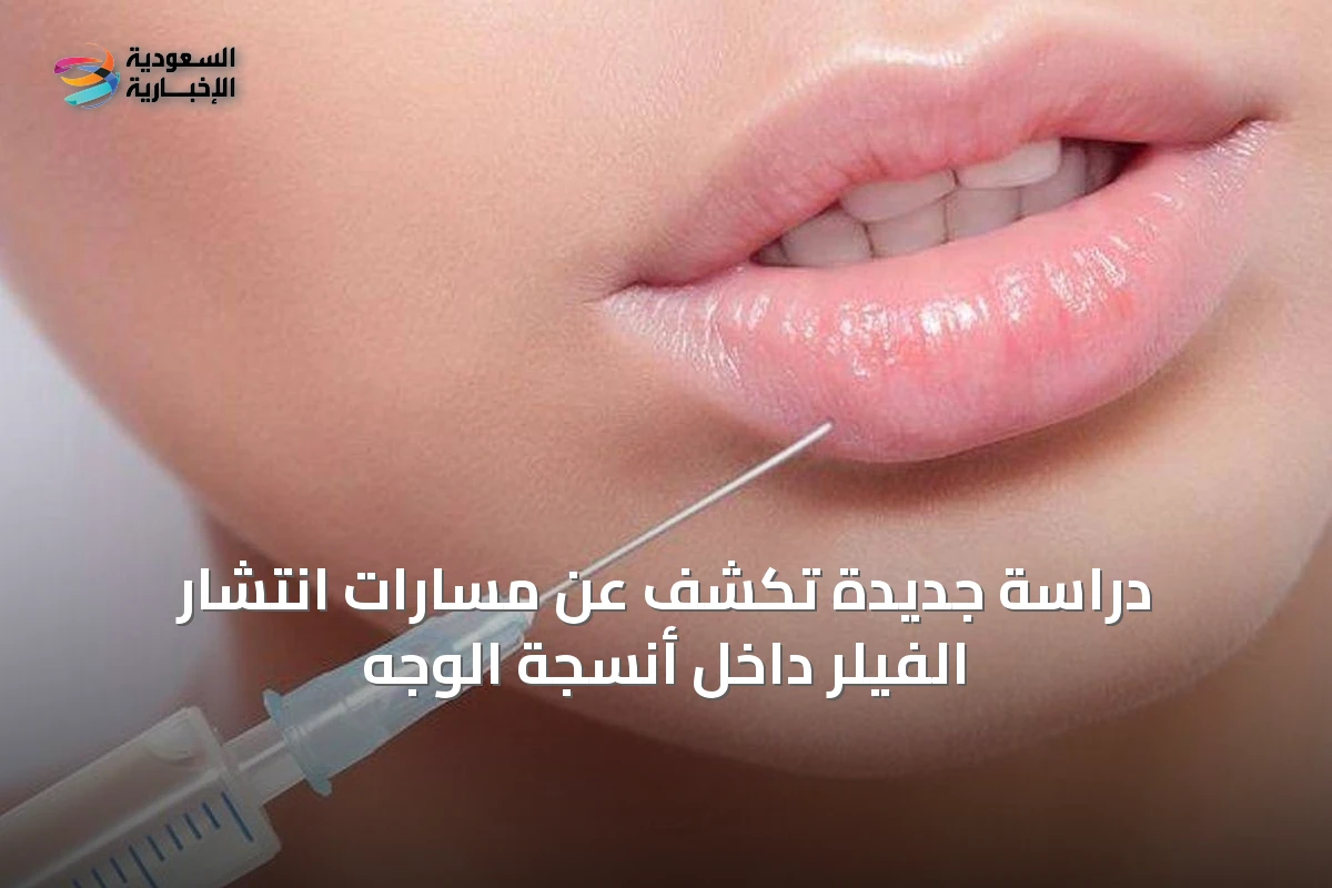 دراسة جديدة تكشف عن مسارات انتشار الفيلر داخل أنسجة الوجه