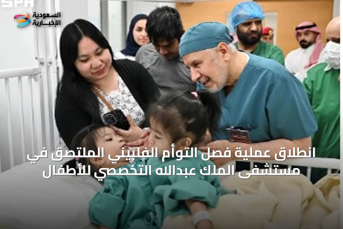انطلاق عملية فصل التوأم الفلبيني الملتصق في مستشفى الملك عبدالله التخصصي للأطفال