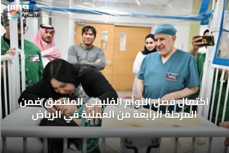 اكتمال فصل التوأم الفلبيني الملتصق ضمن المرحلة الرابعة من العملية في الرياض