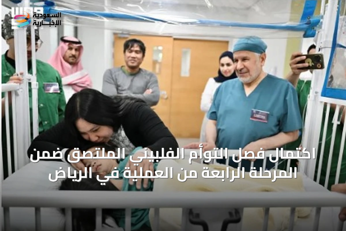 اكتمال فصل التوأم الفلبيني الملتصق ضمن المرحلة الرابعة من العملية في الرياض