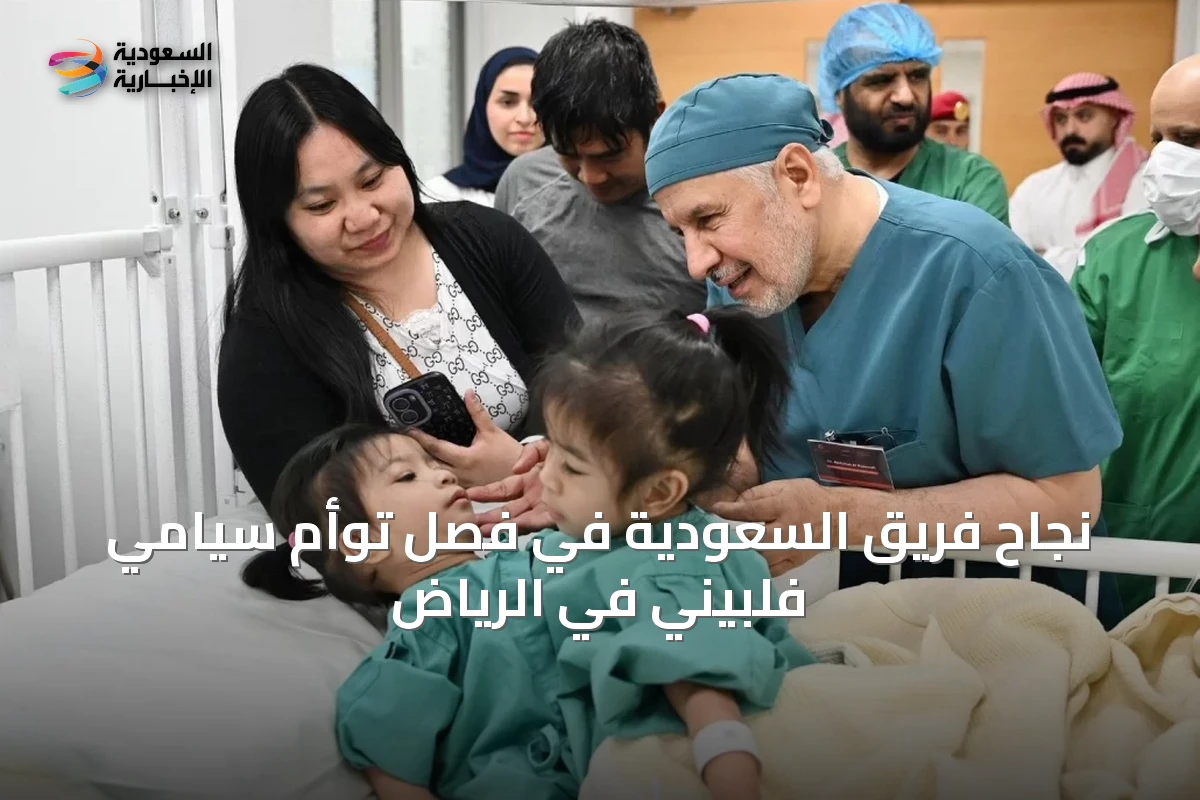 نجاح فريق السعودية في فصل توأم سيامي فلبيني في الرياض
