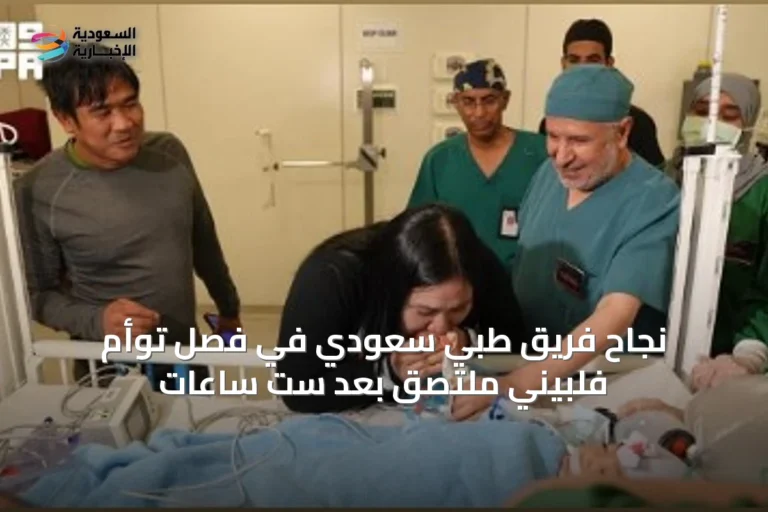 نجاح فريق طبي سعودي في فصل توأم فلبيني ملتصق بعد ست ساعات