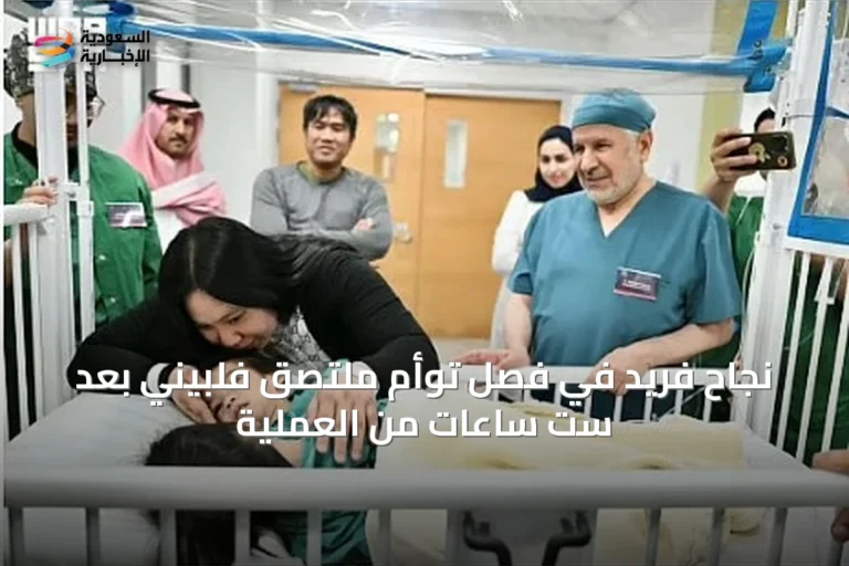 نجاح فريد في فصل توأم ملتصق فلبيني بعد ست ساعات من العملية