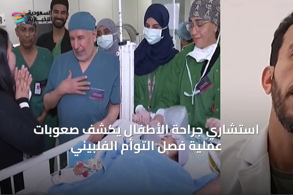 استشاري جراحة الأطفال يكشف صعوبات عملية فصل التوأم الفلبيني