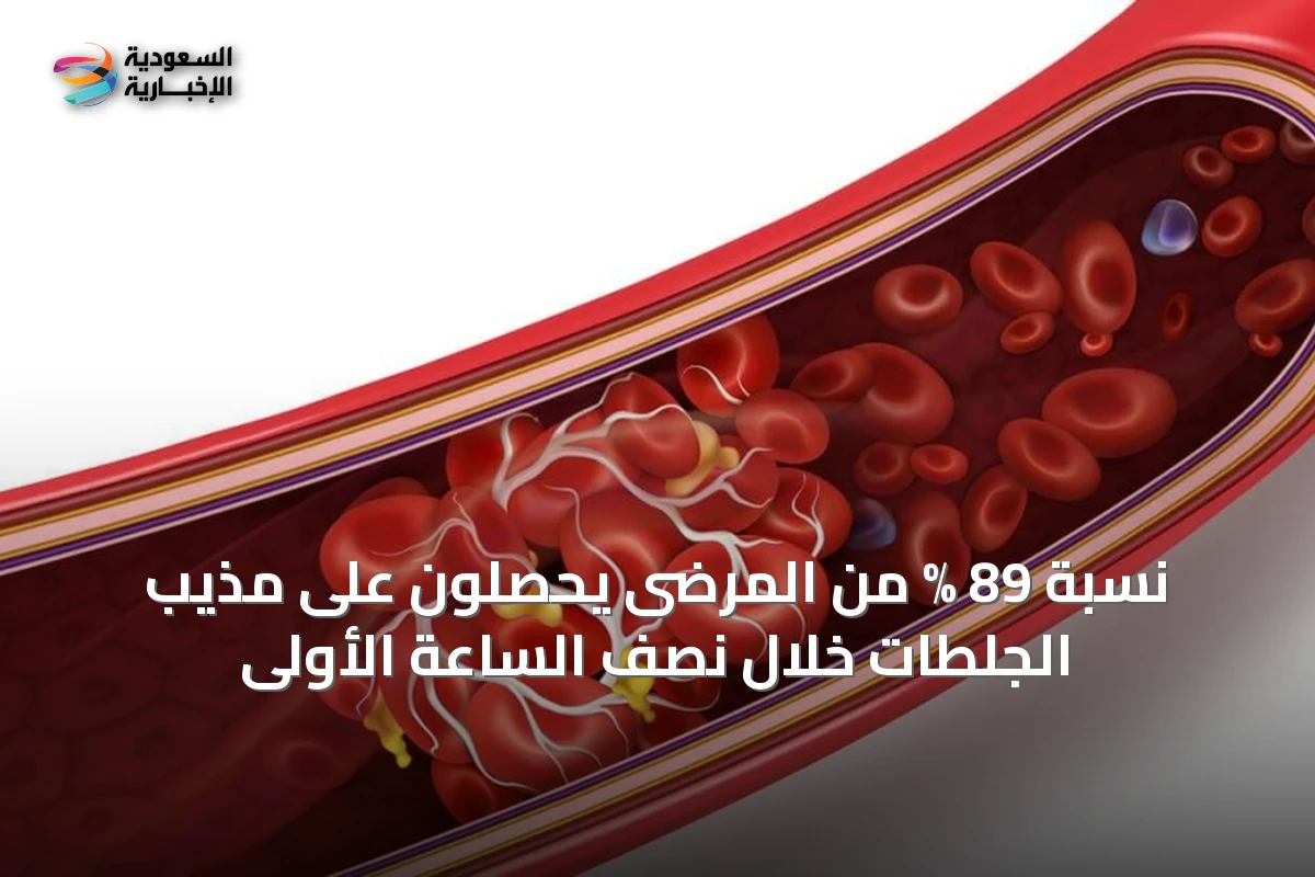 نسبة 89 % من المرضى يحصلون على مذيب الجلطات خلال نصف الساعة الأولى