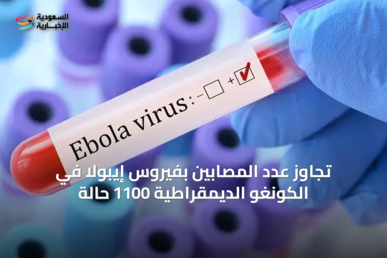 تجاوز عدد المصابين بفيروس إيبولا في الكونغو الديمقراطية 1100 حالة