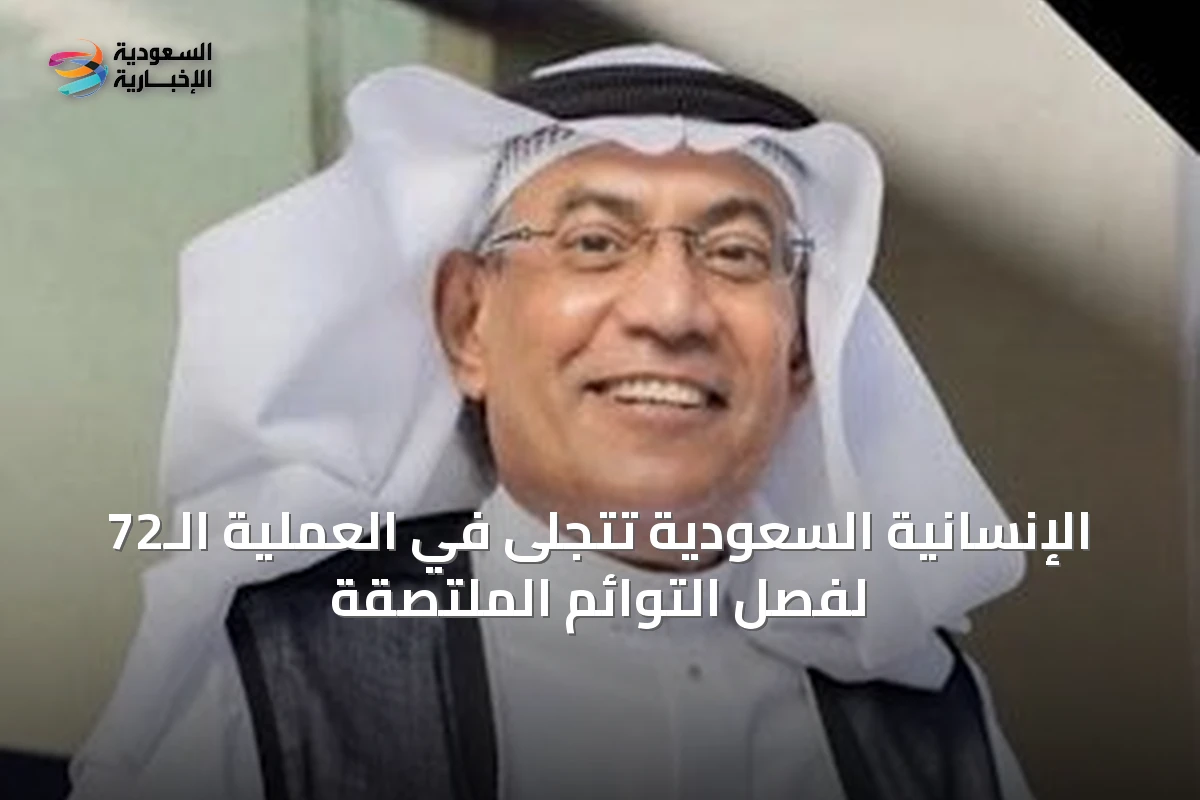 الإنسانية السعودية تتجلى في العملية الـ72 لفصل التوائم الملتصقة