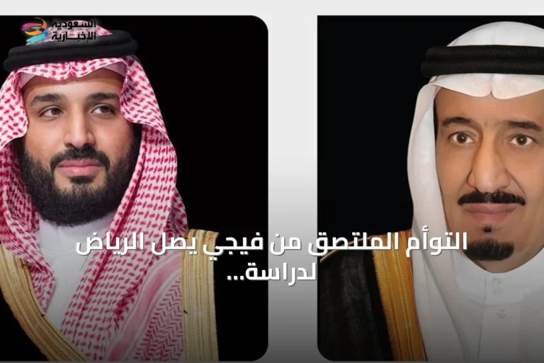 التوأم الملتصق من فيجي يصل الرياض لدراسة إمكانية فصلهما