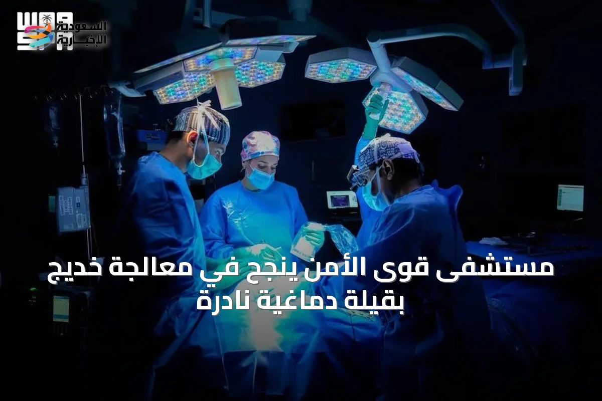 مستشفى قوى الأمن ينجح في معالجة خديج بقيلة دماغية نادرة
