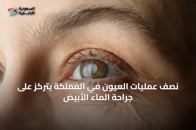 نصف عمليات العيون في المملكة يتركّز على جراحة الماء الأبيض