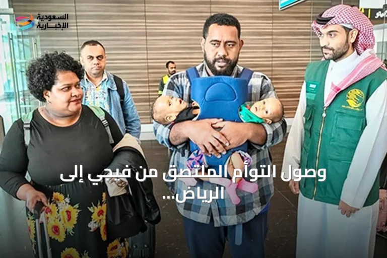 وصول التوأم الملتصق من فيجي إلى الرياض لدراسة حالتهما تحت رعاية البرنامج السعودي