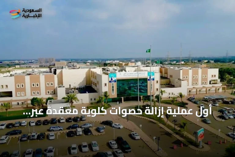 أول عملية إزالة حصوات كلوية معقدة عبر الجلد تُجرى بمستشفى الأمير محمد بن ناصر بجازان