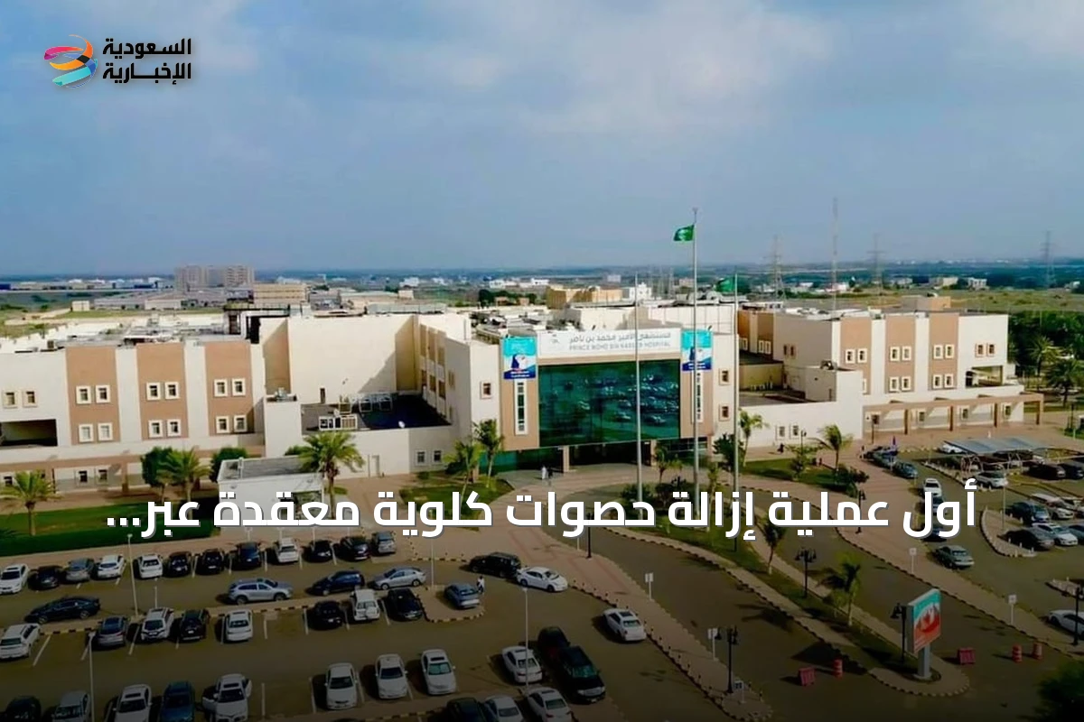 أول عملية إزالة حصوات كلوية معقدة عبر الجلد تُجرى بمستشفى الأمير محمد بن ناصر بجازان