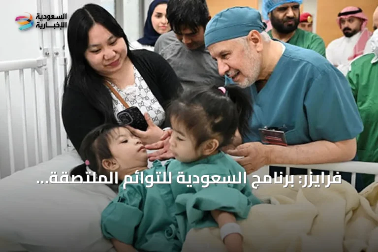 فرايزر: برنامج السعودية للتوائم الملتصقة نموذج دولي للرعاية