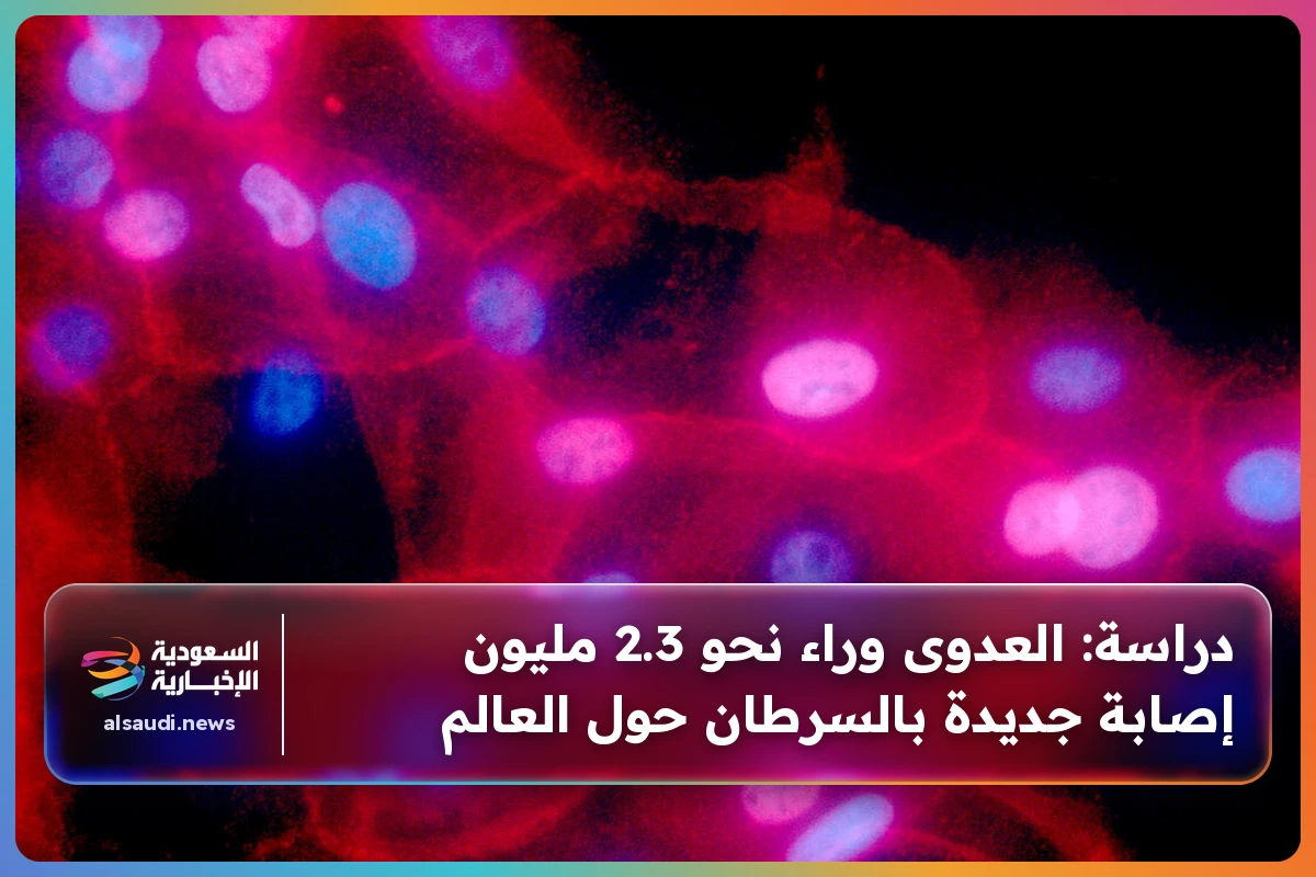 دراسة: العدوى وراء نحو 2.3 مليون إصابة جديدة بالسرطان حول العالم