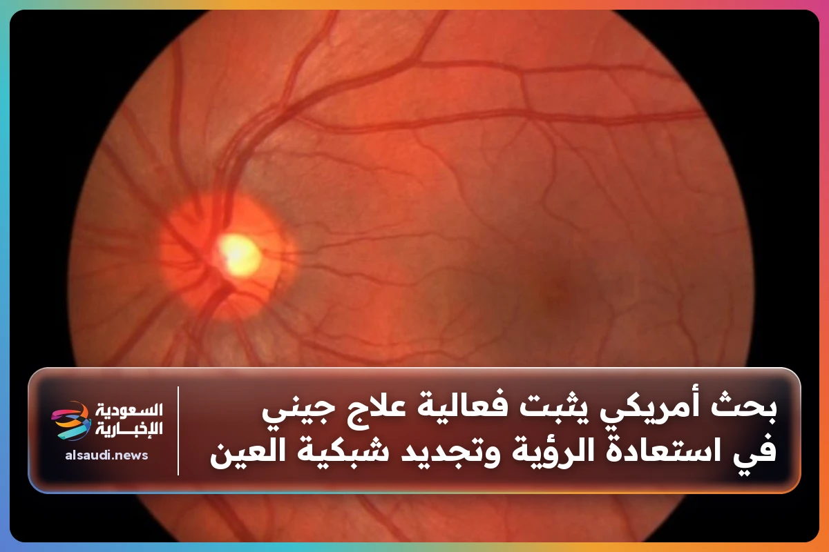بحث أمريكي يثبت فعالية علاج جيني في استعادة الرؤية وتجديد شبكية العين