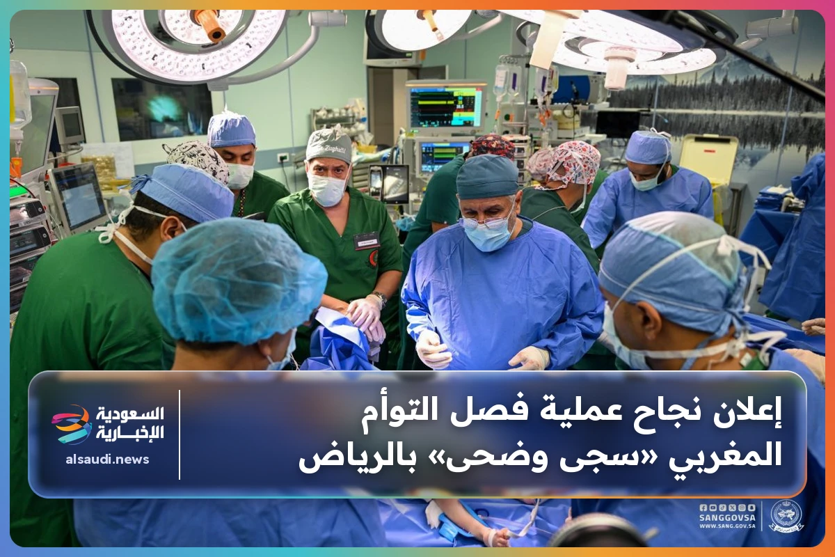 إعلان نجاح عملية فصل التوأم المغربي «سجى وضحى» بالرياض