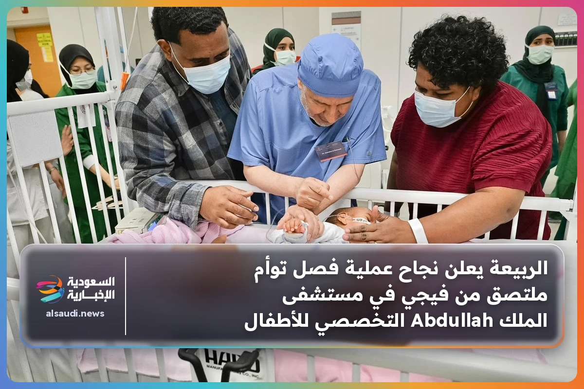 الربيعة يعلن نجاح عملية فصل توأم ملتصق من فيجي في مستشفى الملك Abdullah التخصصي للأطفال