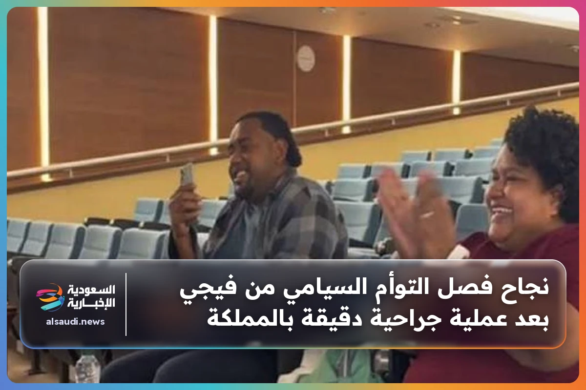 نجاح فصل التوأم السيامي من فيجي بعد عملية جراحية دقيقة بالمملكة