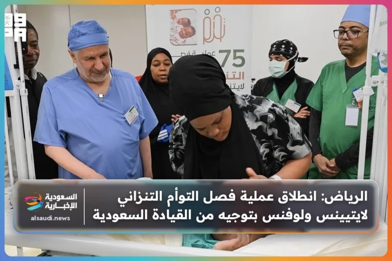 الرياض: انطلاق عملية فصل التوأم التنزاني لايتيينس ولوفنس بتوجيه من القيادة السعودية