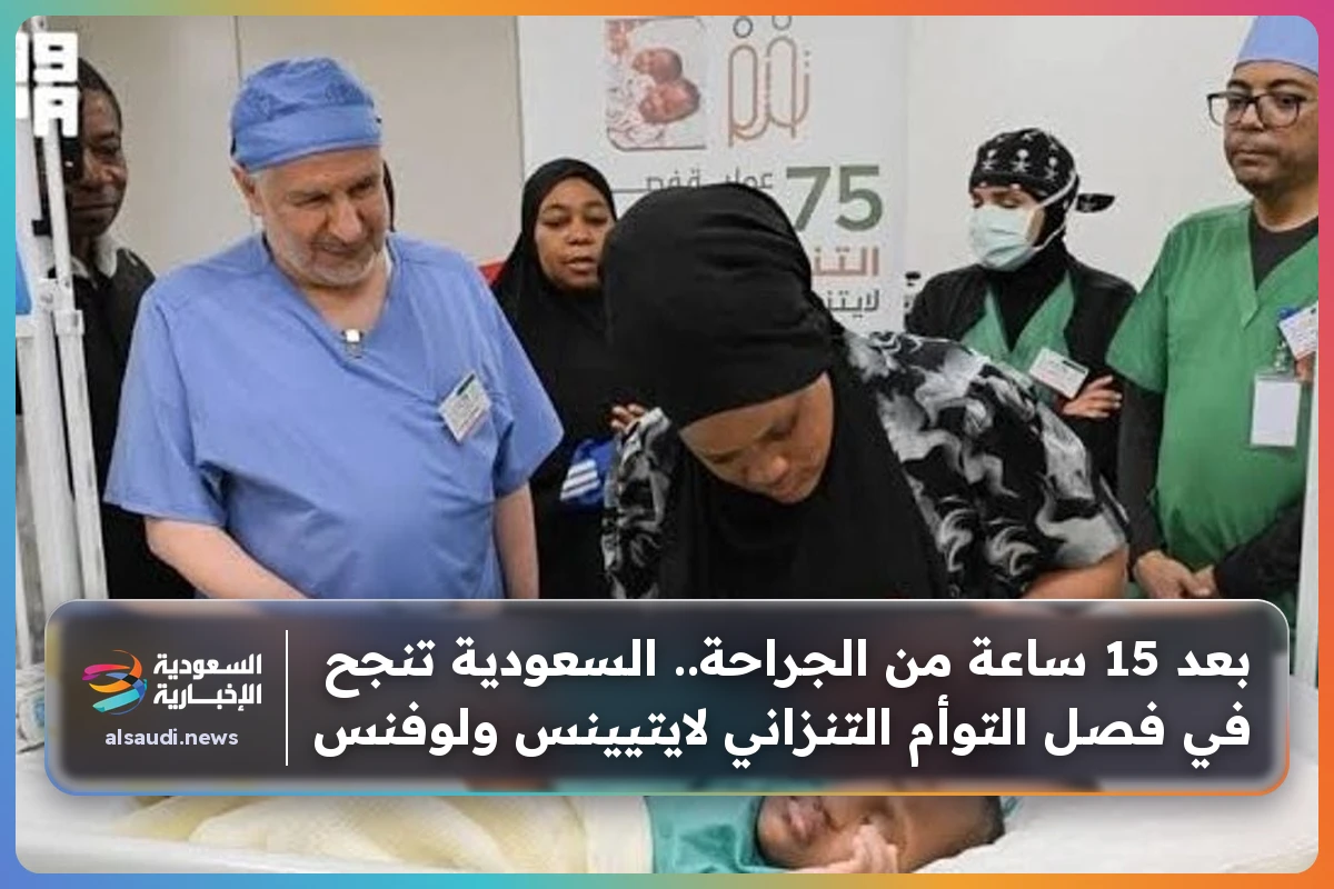 بعد 15 ساعة من الجراحة.. السعودية تنجح في فصل التوأم التنزاني لايتيينس ولوفنس